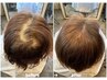 白髪改善・育毛促進・髪のコシUP】真空含浸ヘッドスパ