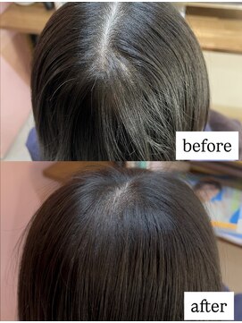 ヘアーズ スケッチ(hair's sketch) つむじ割れ改善！TOKIKATA