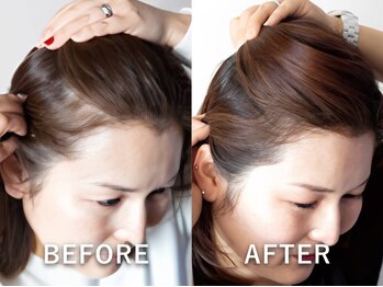 グレースフィオーレ 苫小牧店の写真/【髪の毛/頭皮のエイジングケア】20代～60代まで幅広いお客様がご来店◇効率的に育毛促進◎