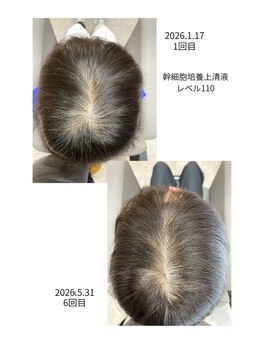 アクシス ファニー(AXIS ファニー)の写真/若い時の毛流やフォルムなどから　年齢とともに変化する髪の「量」や「質」./１本１本を太くしっかりと