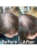 前髪割れ・地肌見え解消/ボリュームアップエクステ
