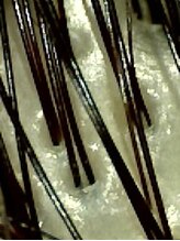 美しい髪は土台である健康な頭皮から生まれます