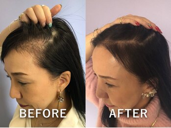 グレースフィオーレ 苫小牧店の写真/髪にボリュームやハリ・コシがなくなってきた方、細毛の方も必見◎髪の毛/頭皮のお悩み解決サロン♪