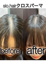 シオ ヘアー デザイン(Sio. hair design)&nbsp;sio hairの前髪の割れ癖改善　クロスパーマのビフォーアフター