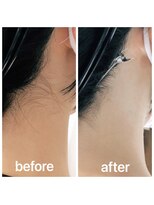 ボスコ 下北沢店(bosco) 【gocci指名限定】襟足メンテナンス