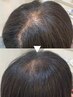 【抜け毛/細毛の悩みを幹細胞ケアで解消】ヒト幹細胞50％+髪質改善￥14000
