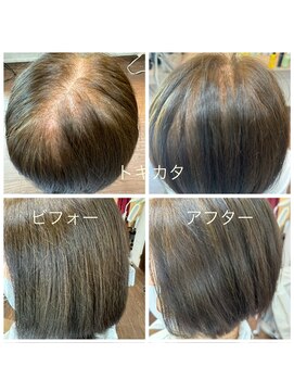 トゥディ(today) トキカタ