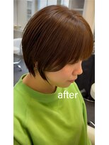ライラ(LAILA) Before after