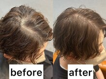 初めての方でも安心：完全個室×マンツーマン接客丁寧なカウンセリング