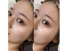 【名駅5分/早朝予約可】名古屋/栄で話題！プロの分析と理論に基づいた施術で、確実な「垢抜け」を叶えます