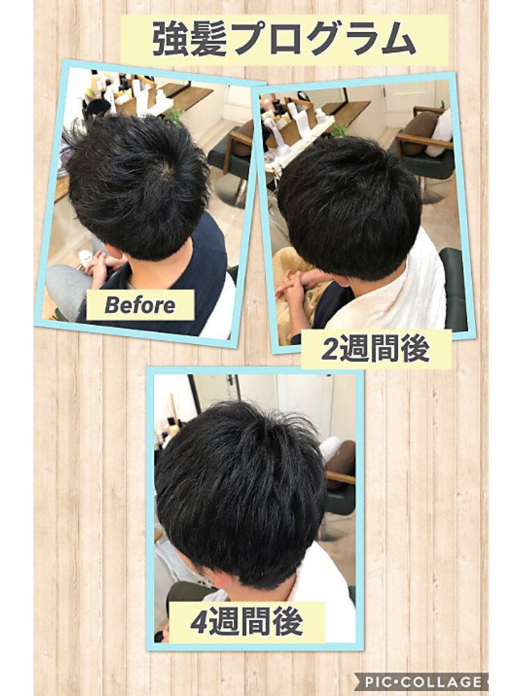 育毛促進】強髪プログラム20％：L227917154｜ロカヒヘアーアオ 