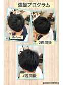 【育毛促進】強髪プログラム20％