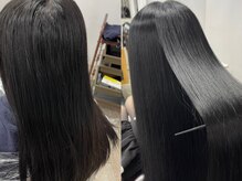 アルファ(ALPHA)