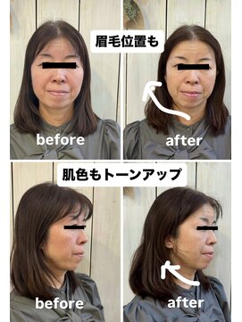 ラシック(La shic) お顔引き上げテラボ－ラ－！！＃テラボ－ラ－＃エクソソ－ム