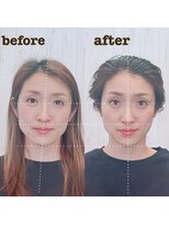 ザラメ(ZARAME)&nbsp;骨格補正スパ+骨格カウンセリング