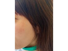 ビューティー サロン ウェリナ(BEAUTY SALON WELINA)
