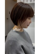ライラ(LAILA) Before after