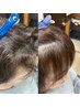 【前髪矯正】気になる前髪のストレート