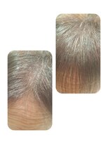 ユーフォルムギンザ(y-Forme Ginza)&nbsp;話題のトキカタ♪前髪編