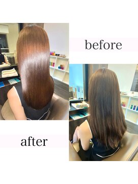 アールサロンプラスキャスパ 自由が丘(Rrsalon+CASPA) 【最新】R.HAS XE(エクソソーム)人幹細胞水素トリートメント