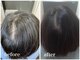 エミ(EMI)の写真/【育毛促進・増毛エクステ特化】育毛促進やボリュームUPに特化◎髪のお悩み、プロに相談してみませんか？