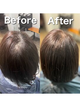 ツムグ 代官山 中目黒(TUMUGU) 地肌見え・つむじ割れ解消/ボリュームアップエクステ