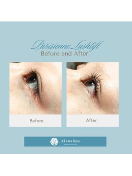 アラナ(Alana) パリジェンヌラッシュリフト