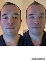 アクティフ(actif)&nbsp;【大口式筋膜ヘッドスパ】名古屋の美容室actif 頭皮改善/ MJ有紀