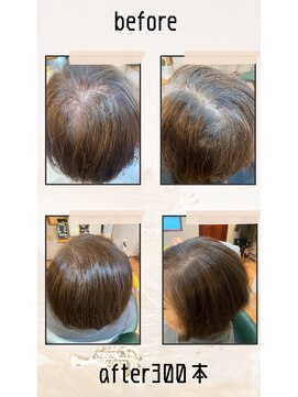 チッタ(chitta) エアリーエクステ増毛