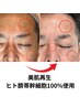 【美肌促進・男性専用】ヒト臍帯幹細胞上清液100%使用！￥44000→￥27500