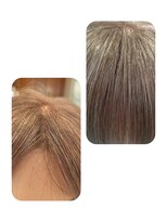 ユーフォルムギンザ(y-Forme Ginza)&nbsp;話題のトキカタ♪前髪編