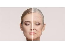 活性酸素が引き起こす髪・地肌のダメージとは？