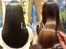 リノア(LINOA)