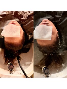 ヘアードレスビュー(hair dress V.I.E.W)の写真/【高濃度水素×極上ケア】九州唯一の最新ヘッドスパ『DETOSPA』で頭皮をリセットし、芯から潤う美髪へ♪