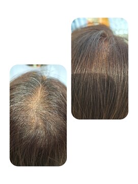 話題のトキカタ♪頭頂部編