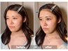 育毛促進/髪質改善/美肌★ヘッドスパ＋水光ジェット＋髪質改善トリートメント
