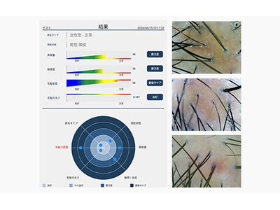 高精度スコープカウンセリングで頭皮髪の健康状態を確認します♪