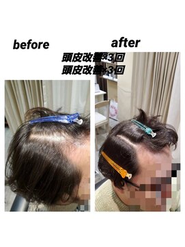 髪質改善 ソアリス 烏丸丸太町店(soiris) 頭皮改善エステ(細毛トリートメント)
