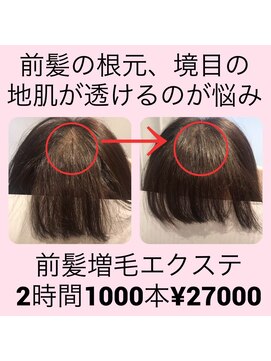 増毛エクステ専門店 エクステルーム 渋谷店(exteroom) エアエク増毛エクステヘアループ★1000本！前髪毛量アップ