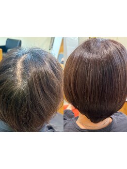 【話題のトキカタ導入サロン！】ハサミも薬剤も使わない毛流れ矯正&髪質頭皮改善！TOKIKATAはじめました！