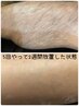 【腕・足★本格的処理】痛みの少ない毛の処理（モニター価格）