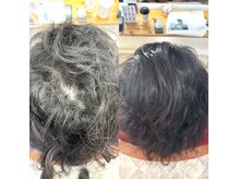 凪の旅先の雰囲気(抗がん剤治療後、産後抜け毛、円形 脱毛などご相談ください)