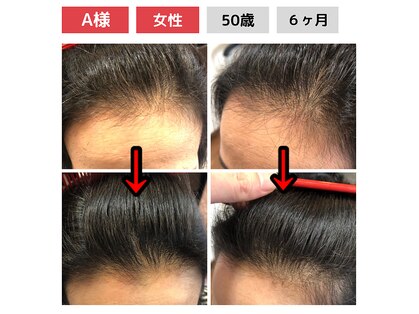 コージーヘア(cozy hair)の写真