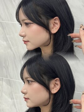 リュネル(Lunel) 似合わせ顔周りカット