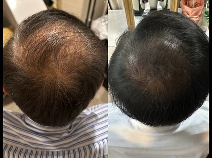 ドクターヘアー(Dr.hair)の写真