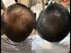 ドクターヘアー(Dr.hair)の写真