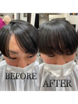 コレットヘア(Colette hair) テレビで話題 ヘアリセッター メンズ 前髪の割れ改善