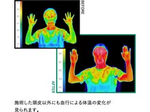 サーモグラフィー測定でも