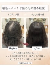 エクステサロンエム(EXTE SALON M)&nbsp;つむじの割れカバー/増毛エクステ/ヘアループ