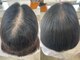 マリーゴールド(MARIGOLD)の写真/特許技術ヘアリセッターで生え癖改善し、扱いやすい髪に◎美容室帰りのスタイルをキープできる♪